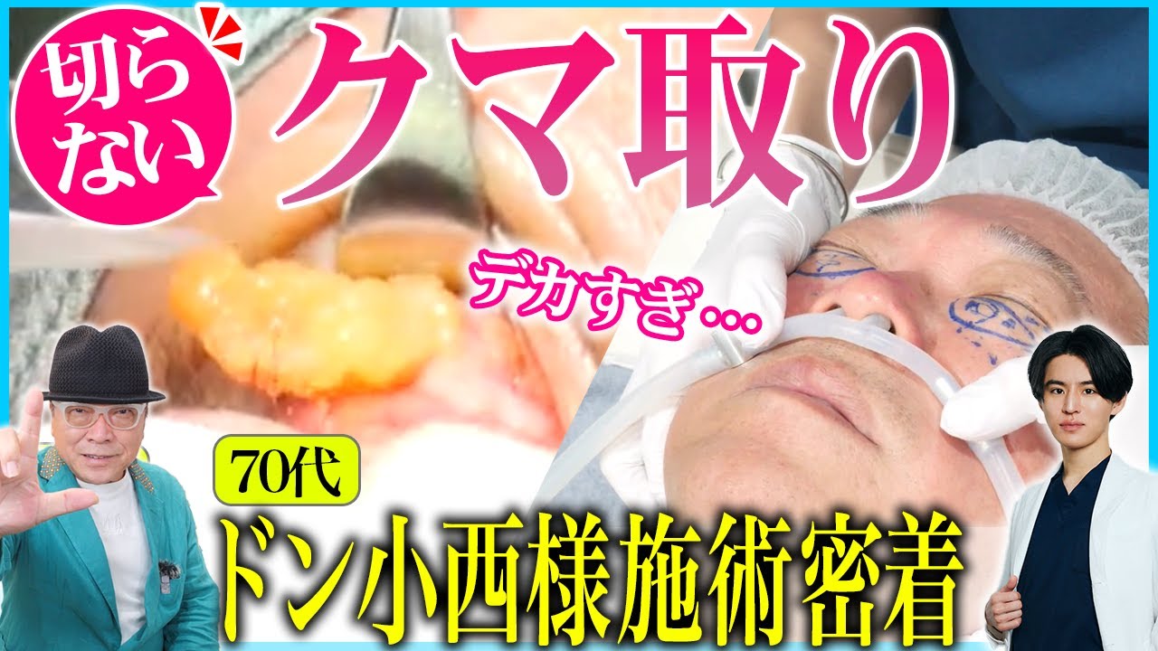 【施術完全密着】クマ取り施術で-10歳！？　70代のドン小西様がどう変わったか、全部見せちゃいます！