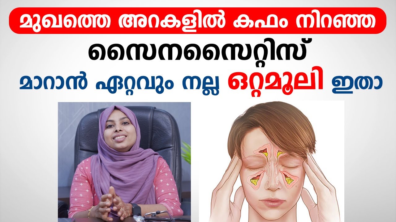 മുഖത്ത് കഫം നിറഞ്ഞ സൈനസൈറ്റിസ് മാറാൻ ഒറ്റമൂലി ഇതാ | Sinusitis Maran | Arogyam