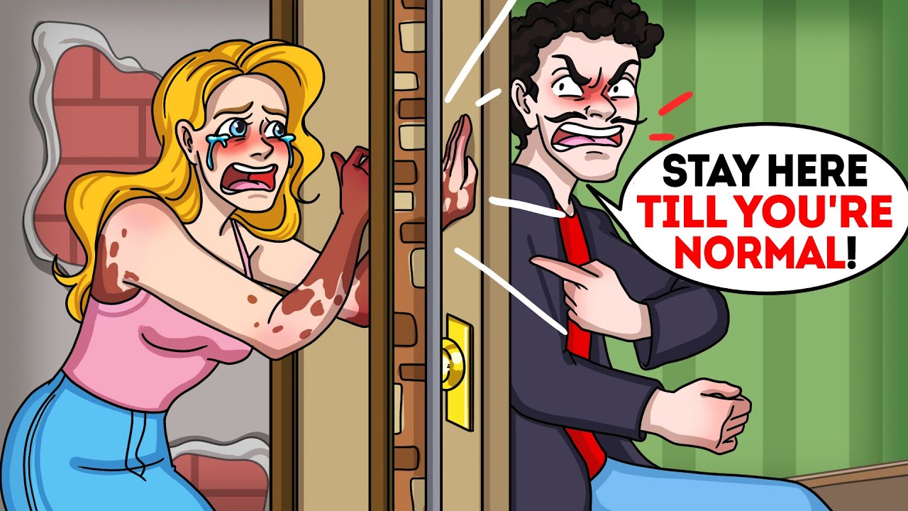 Husband made me isolate because of my skin