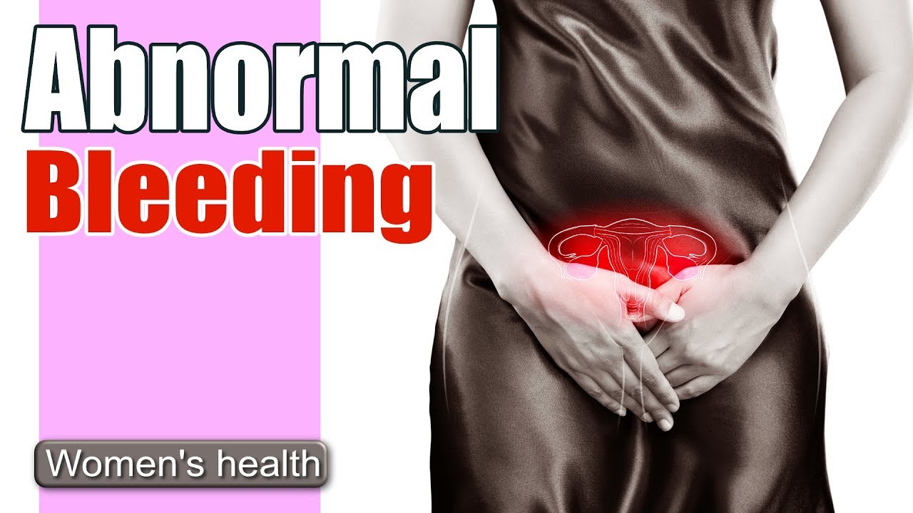 Bleeding Between Periods | Abnormal Uterine Bleeding