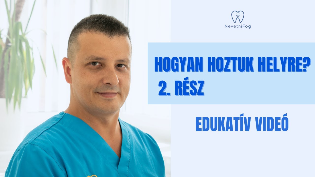 “Hogyan hoztuk helyre? 2. rész ” | Tudásanyag | NevetniFog - Dr. Kovács Roland
