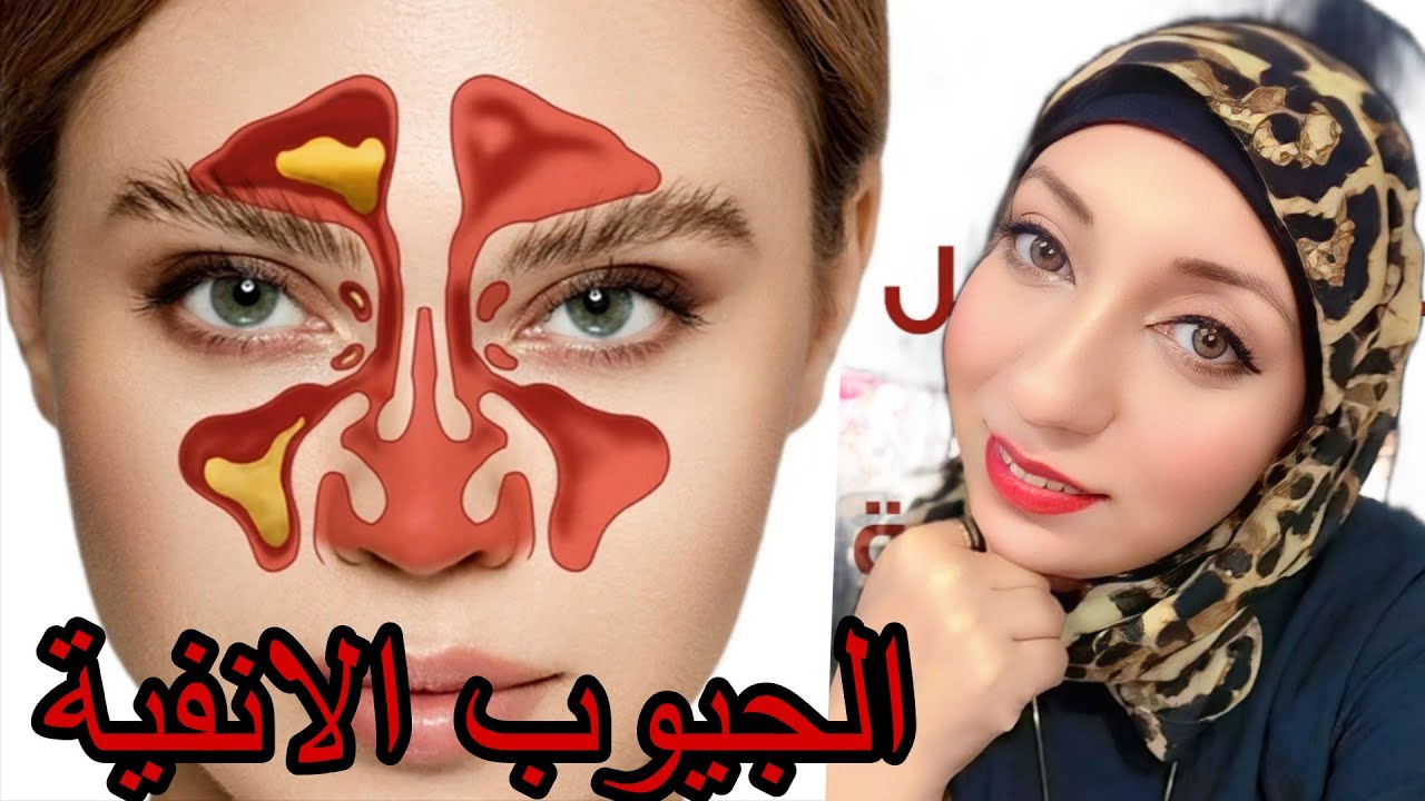 الجيوب الانفيه اسبابها وطرق علاجها في المنزل