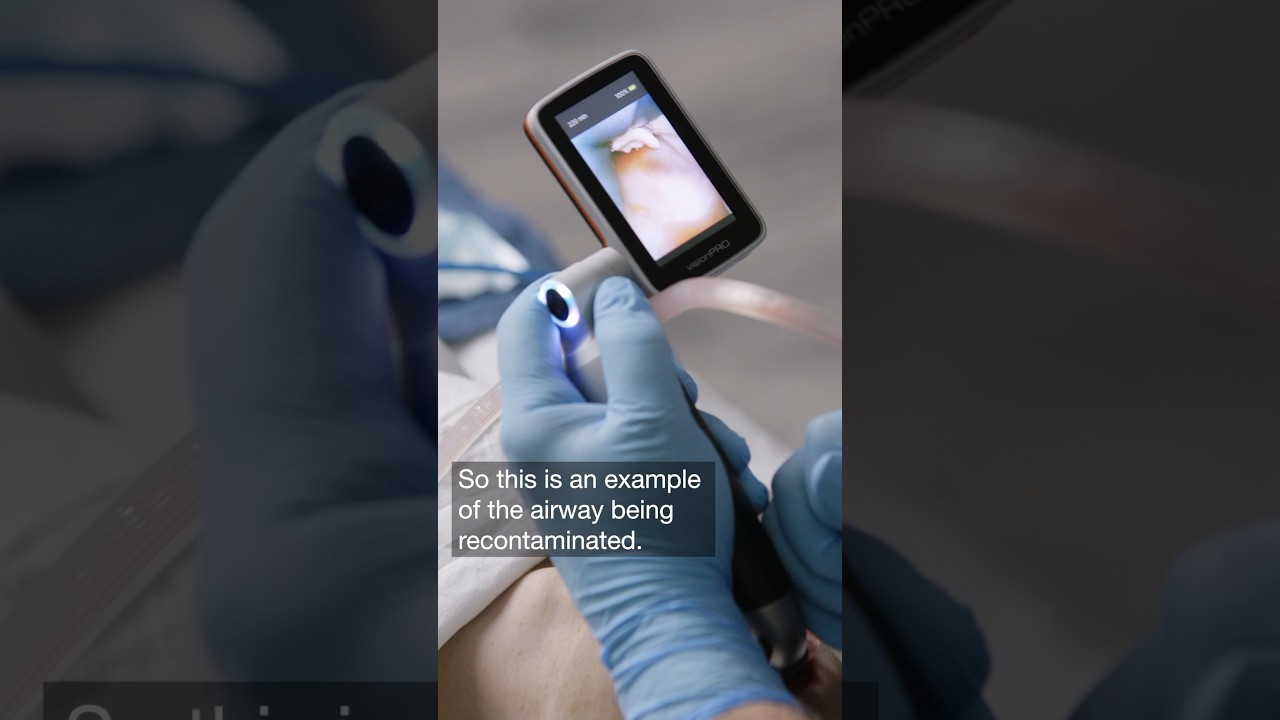 S.A.L.A.D. intubation technique by Dr. Jim DuCanto