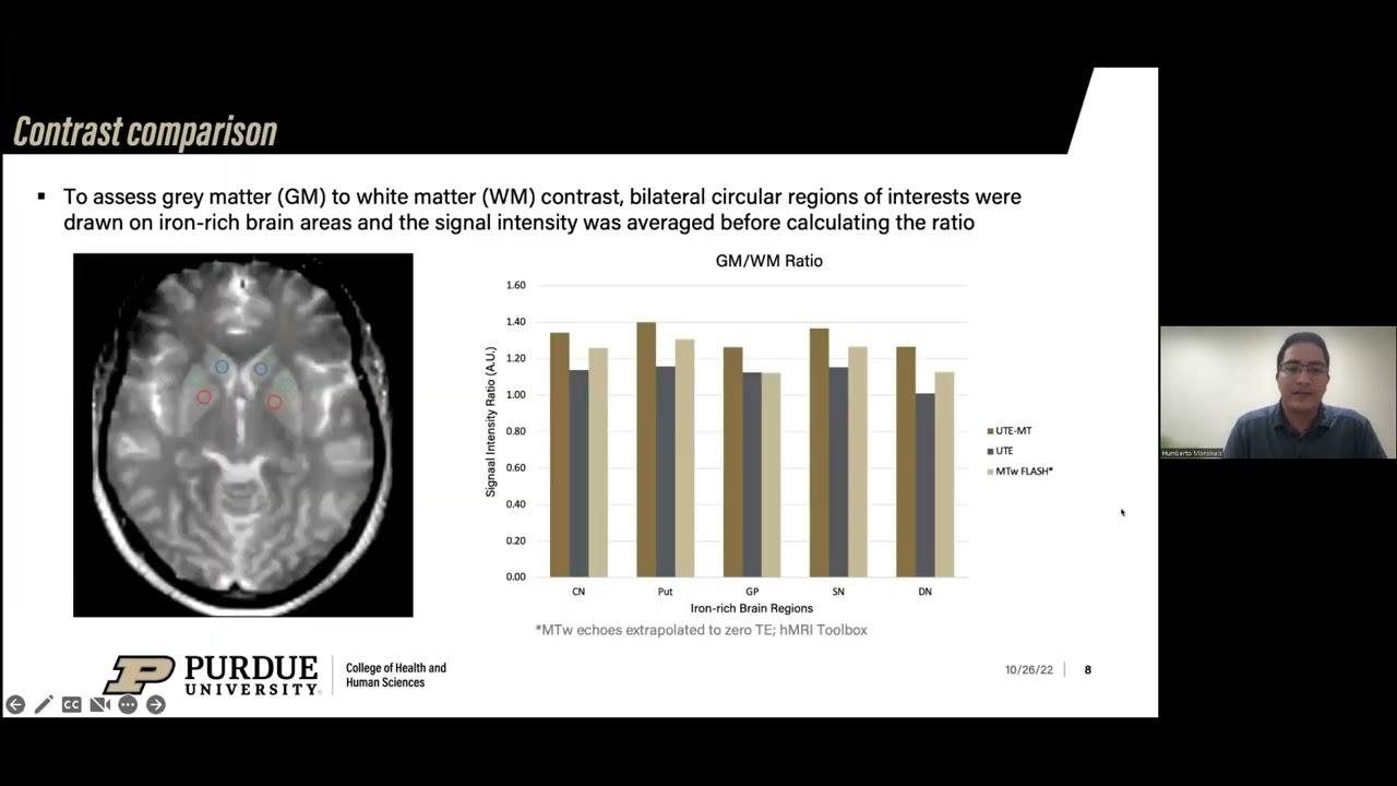 Humberto Monsivais - Ultrashort echo time magnetization transfer (UTE-MT) for deep brain imaging