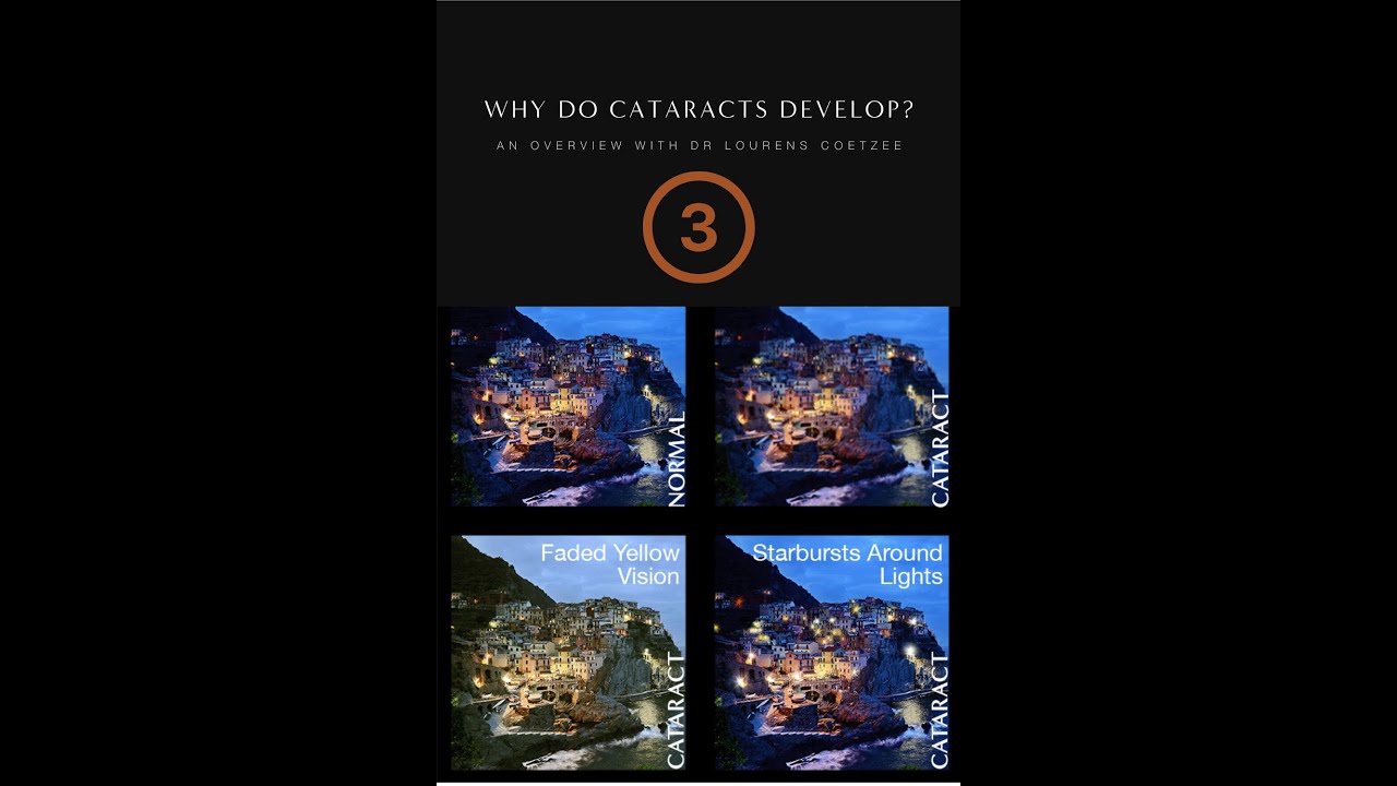 Why Cataracts Develop
