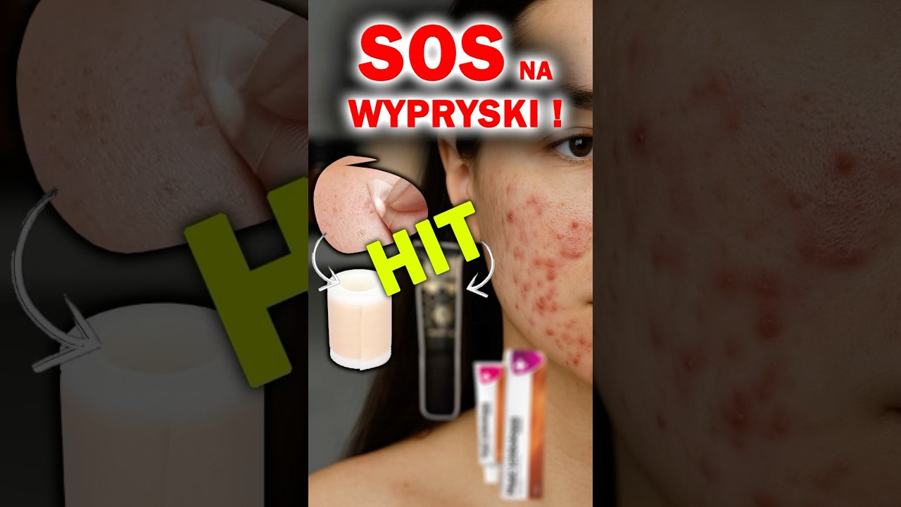 NATURALNY HIT za 16 zł ! wypryski * grudki * kaszka * trądzik #shorts #pielegnacja #trądzik