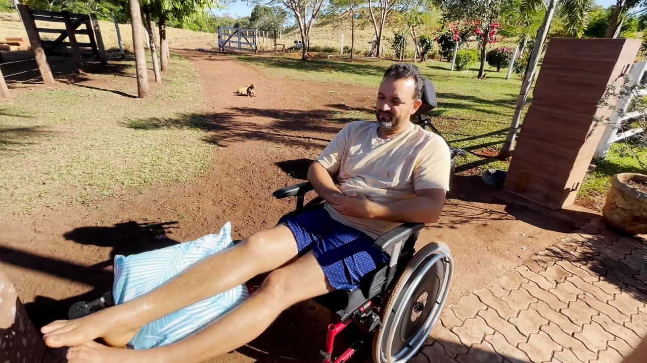 EDMILSON SENTA E MOVIMENTA A PERNA 😭 LOUVADO SEJA DEUS  🙏ESTÁ SE RECUPERANDO 🙌 EDMILSON ADORNO