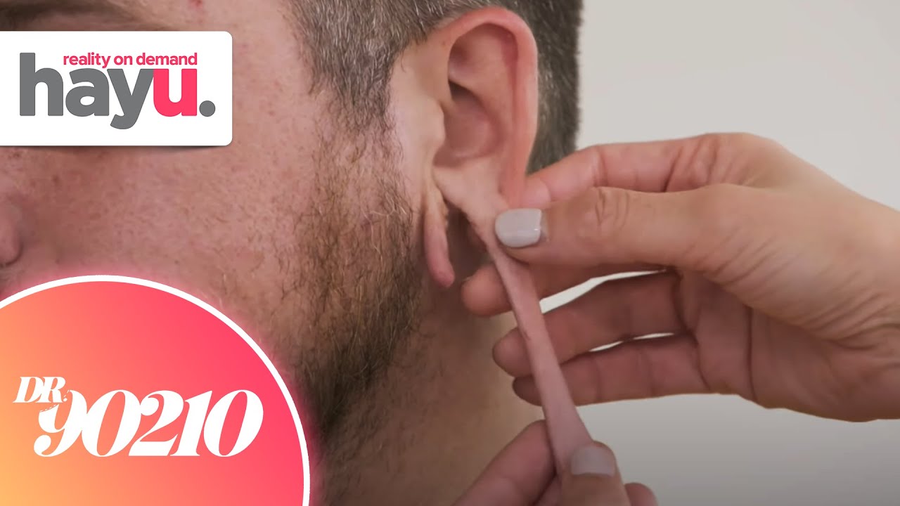 Ear Lobes So Long They Double As Ear Plugs | Season 1 | Dr. 90210