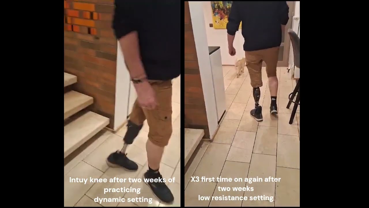 Intuy Knee vs. Genium X3