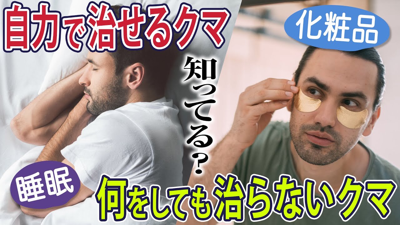 【目の下のクマ】睡眠やセルフケアで改善できるクマはあるのでしょうか？【湘南美容クリニック】