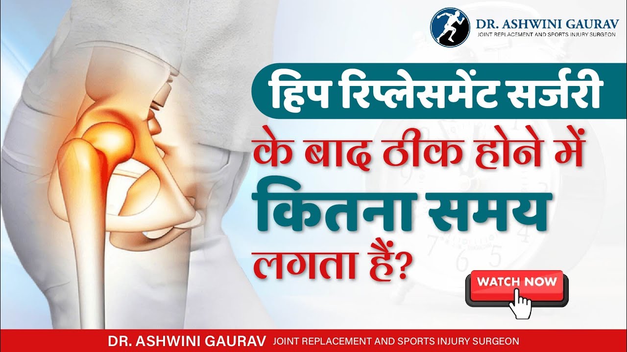 हिप रिप्लेसमेंट के बाद ठीक होने में कितना समय लगता हैं? Recovery Time After Hip Replacement In Patna