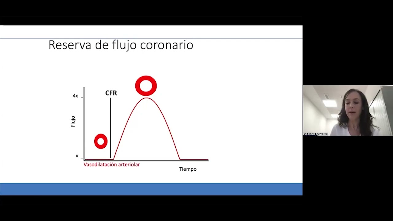 Evaluación y manejo del paciente con disfunción microvascular coronaria