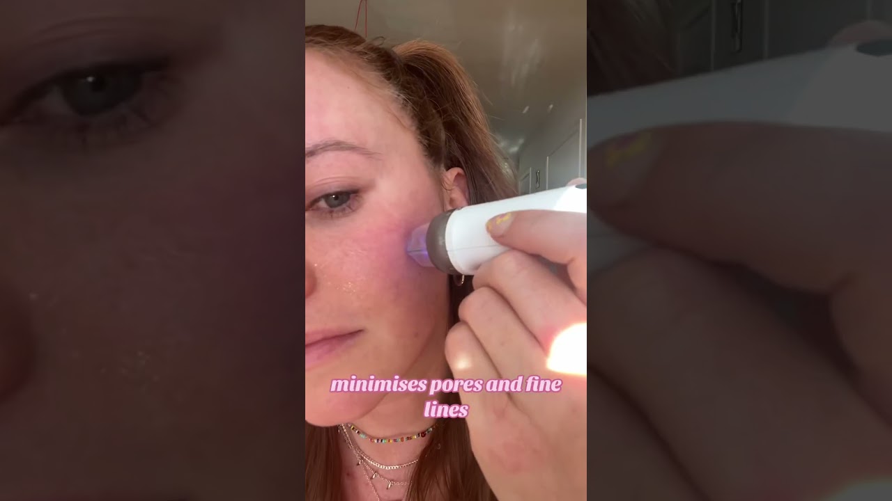 Bio Pen Q2 is here