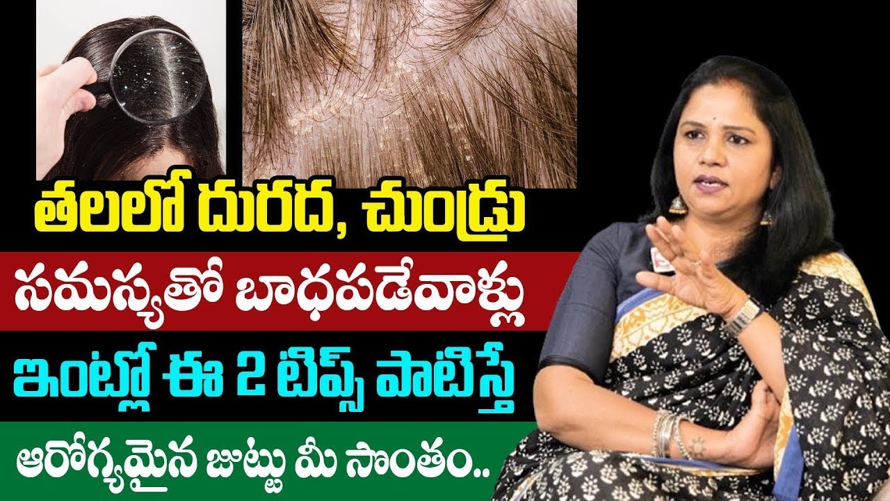 Dry Scalp Causes & Best Home Remedies | Tips by Nutritionist Vanaja Ramisetty