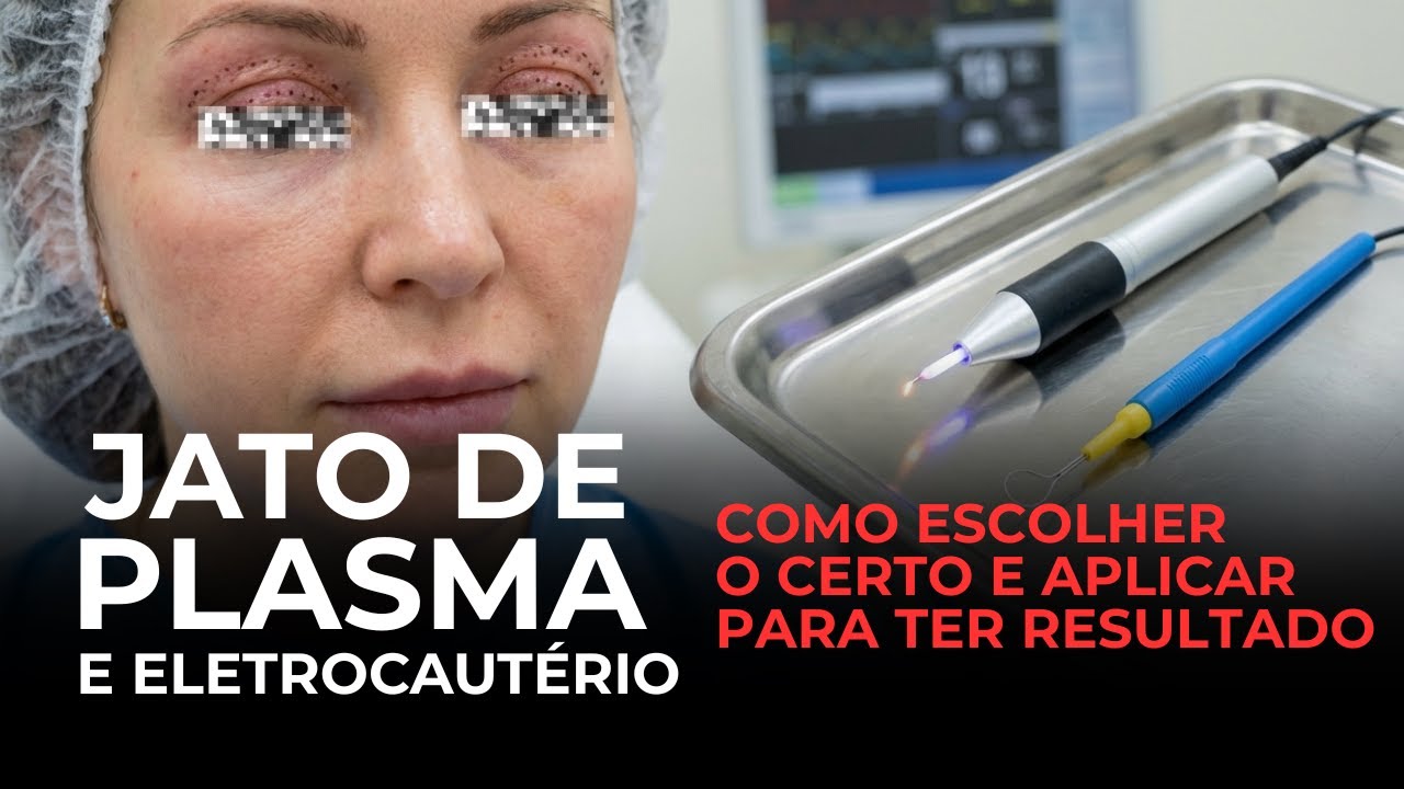 Jato de Plasma e Eletroccautério