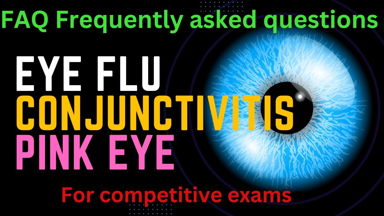 Eye flu or Conjunctivitis or Pink eye (Frequently asked questions with answer) FAQs and quiz.