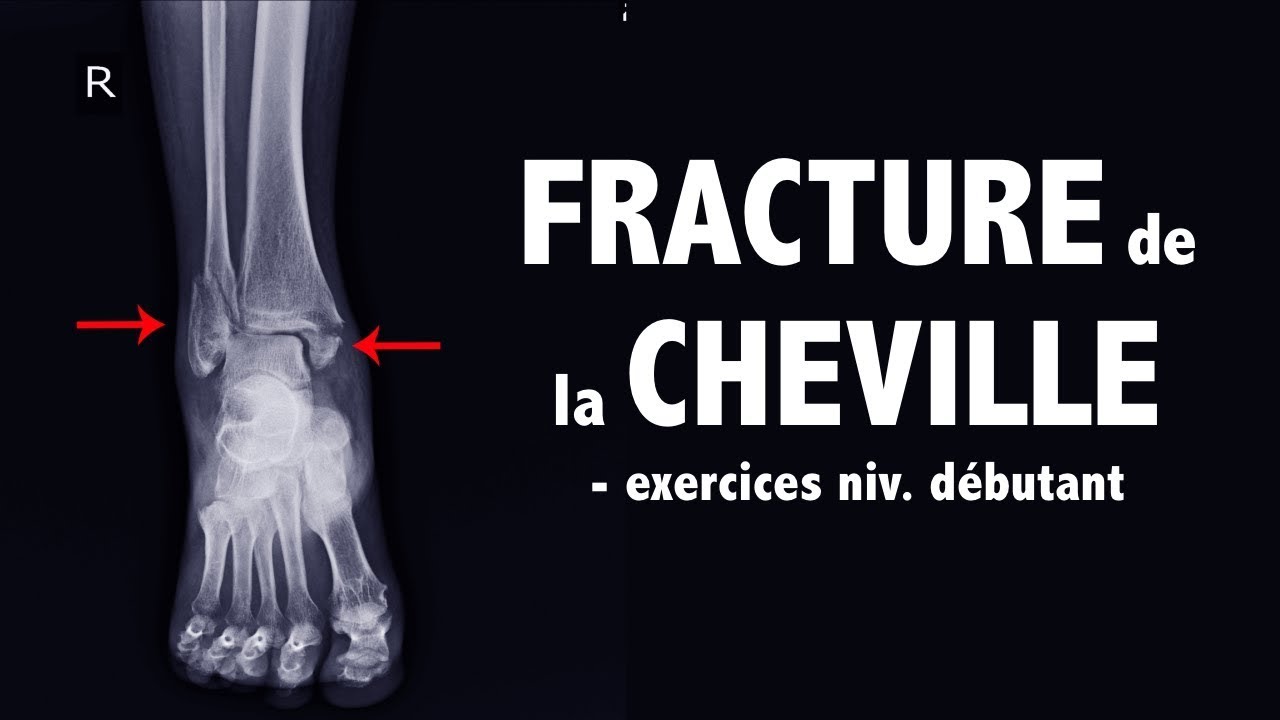 FRACTURE de la cheville: des exercices de rééducation efficaces - niv. débutant