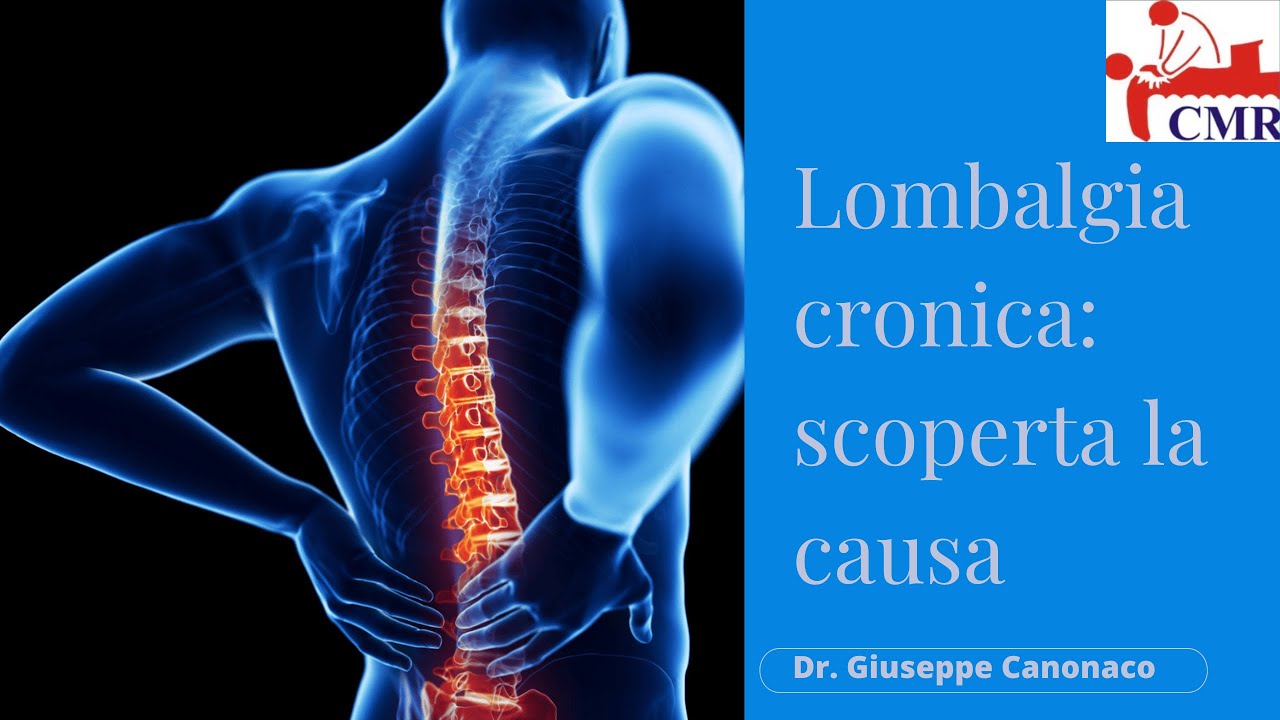LOMBALGIA CRONICA: SCOPERTA LA CAUSA