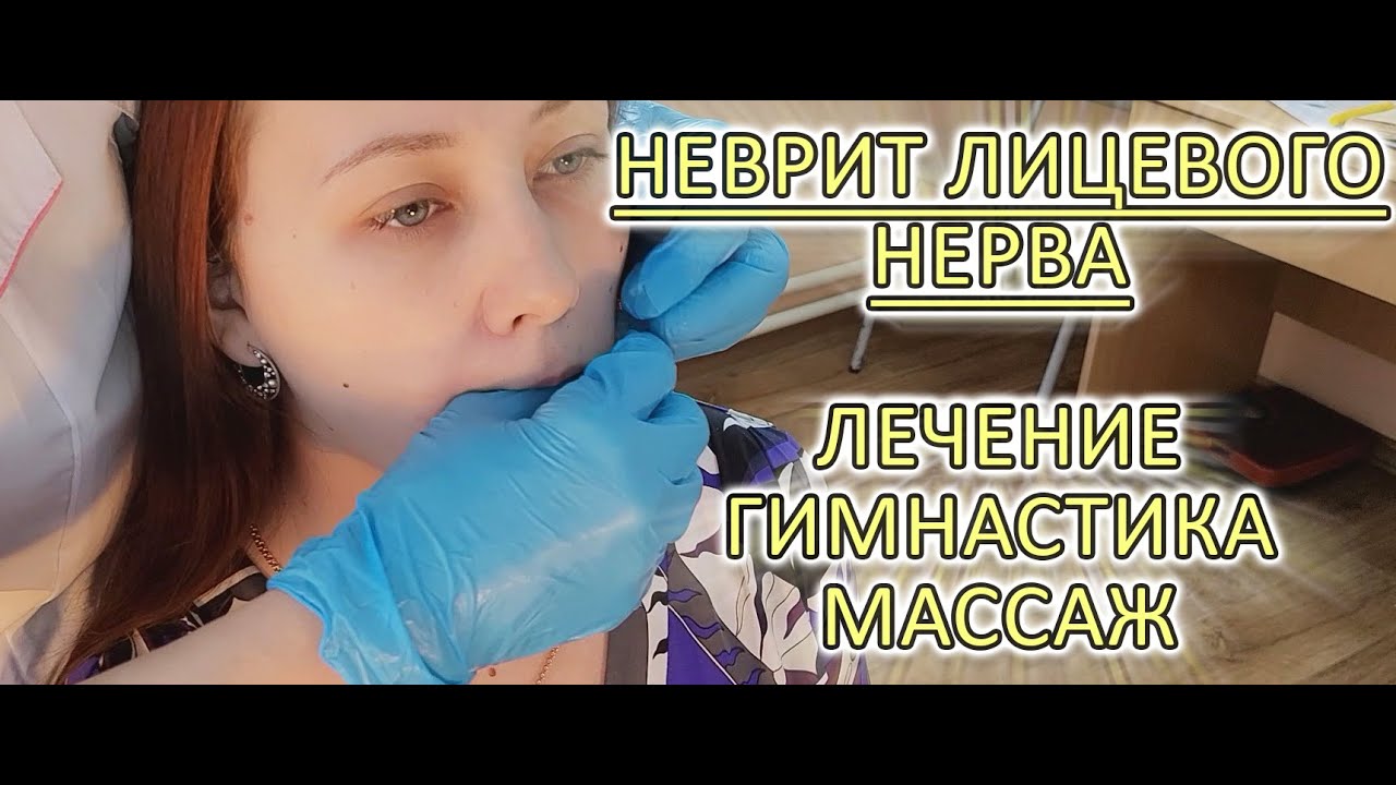 Что делать при неврите лицевого нерва!!!