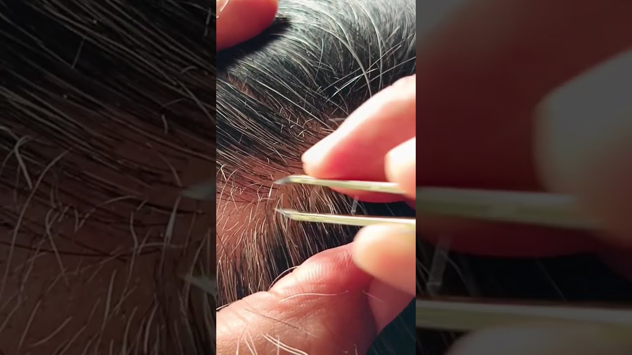 Most satisfying white hair removal in music#49#music background