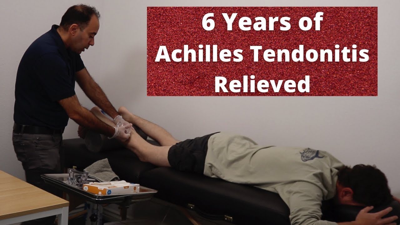 6 Years of * Achilles Tendonitis *  RELIEVED In No Time (REAL TREATMENT!!!)