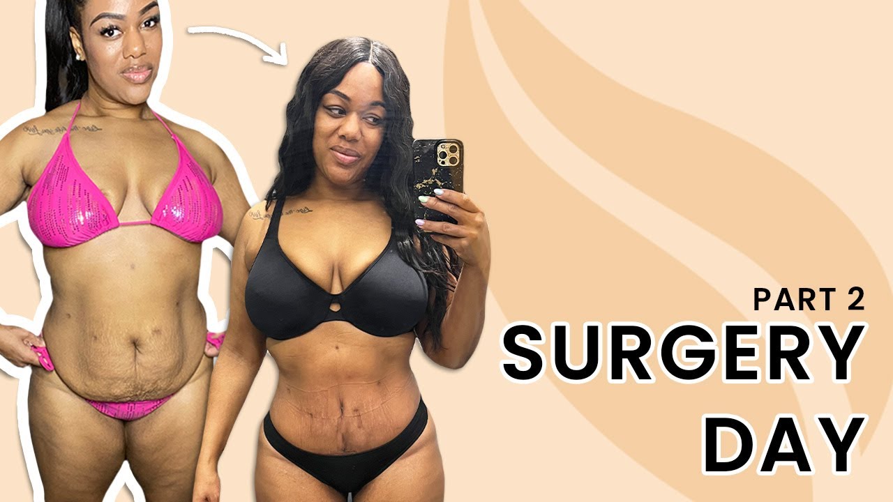 Bryanna's Surgery Day | AbEX Tummy Tuck Alternative Surgery Day & What to Expect at Sono Bello