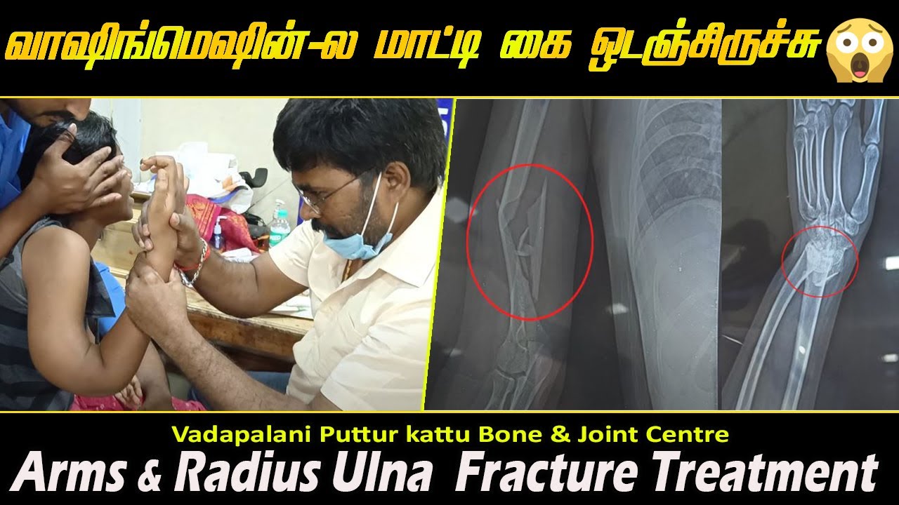 Puttur kattu | https://youtu.be/3qFCCZoz6pQ | Dr.RS.Velumani