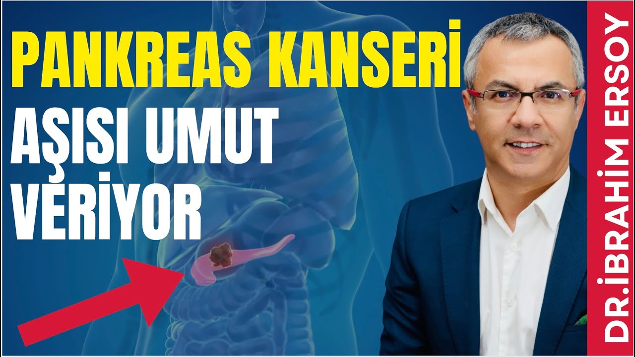 Pankreas Kanseri Tedavisinde Umut Verici Sonuçlar