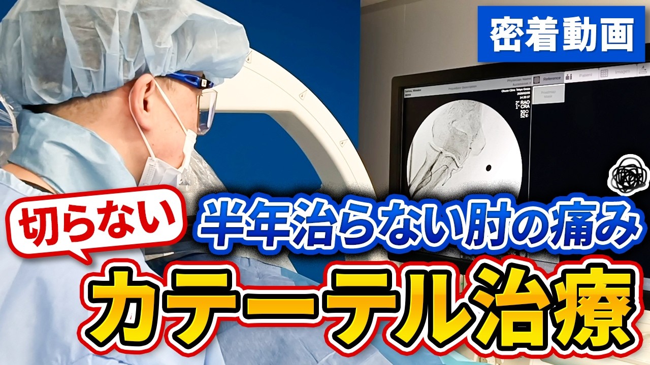 半年続いた肘の痛み ― 衝撃波でも改善しなかった方へ