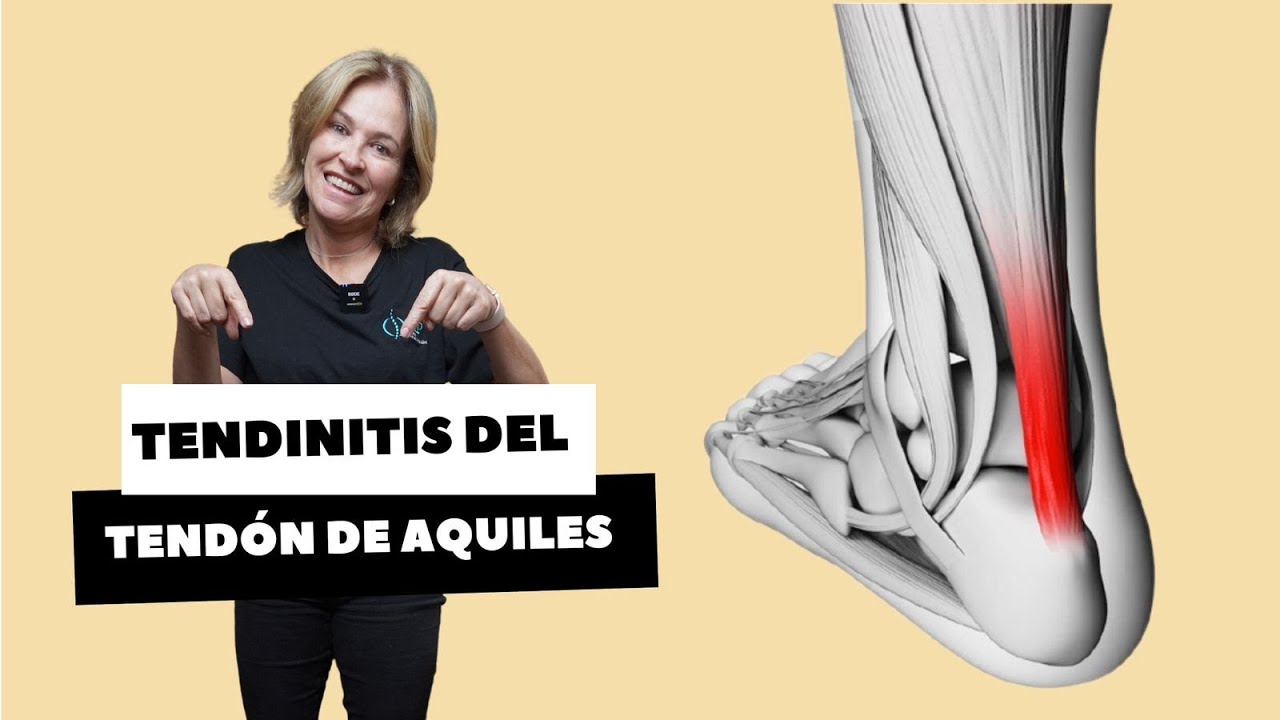 TENDINITIS DE TEND&Oacute;N DE AQUILES, zapatos, ejercicios y errores comunes