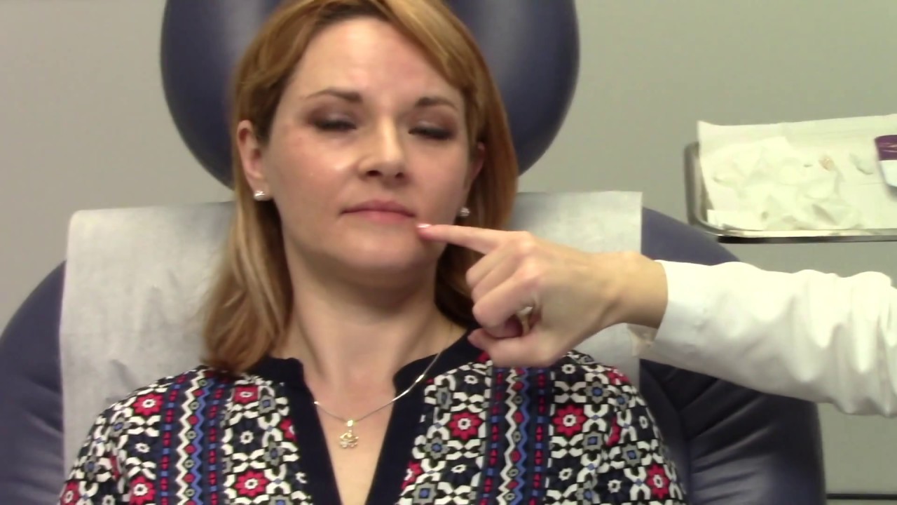 Lifting the corners of the mouth with Dr. Trent Injecting Juvederm Ultra Plus XC