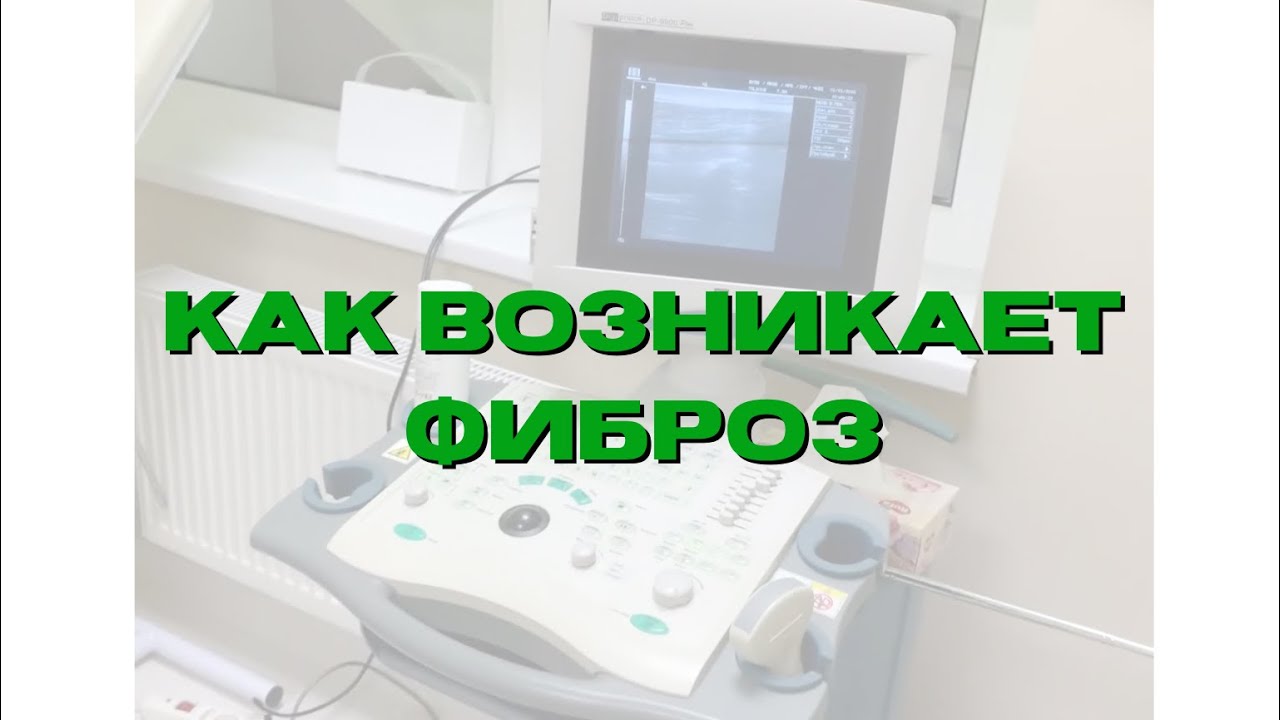 Почему Боль в спине НЕ проходит или Как  возникает МИОФИБРОЗ?