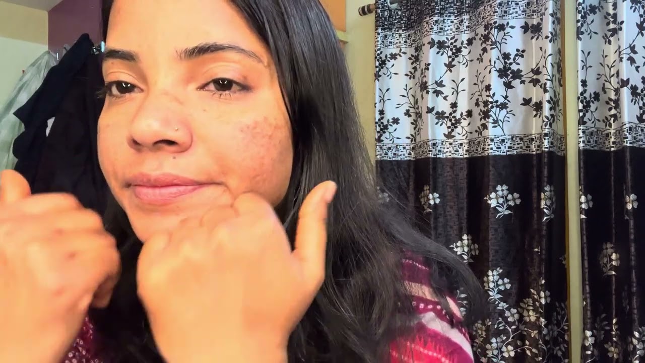 pigmentation  face care | झाइया कैसे कम कोर घर पर 
