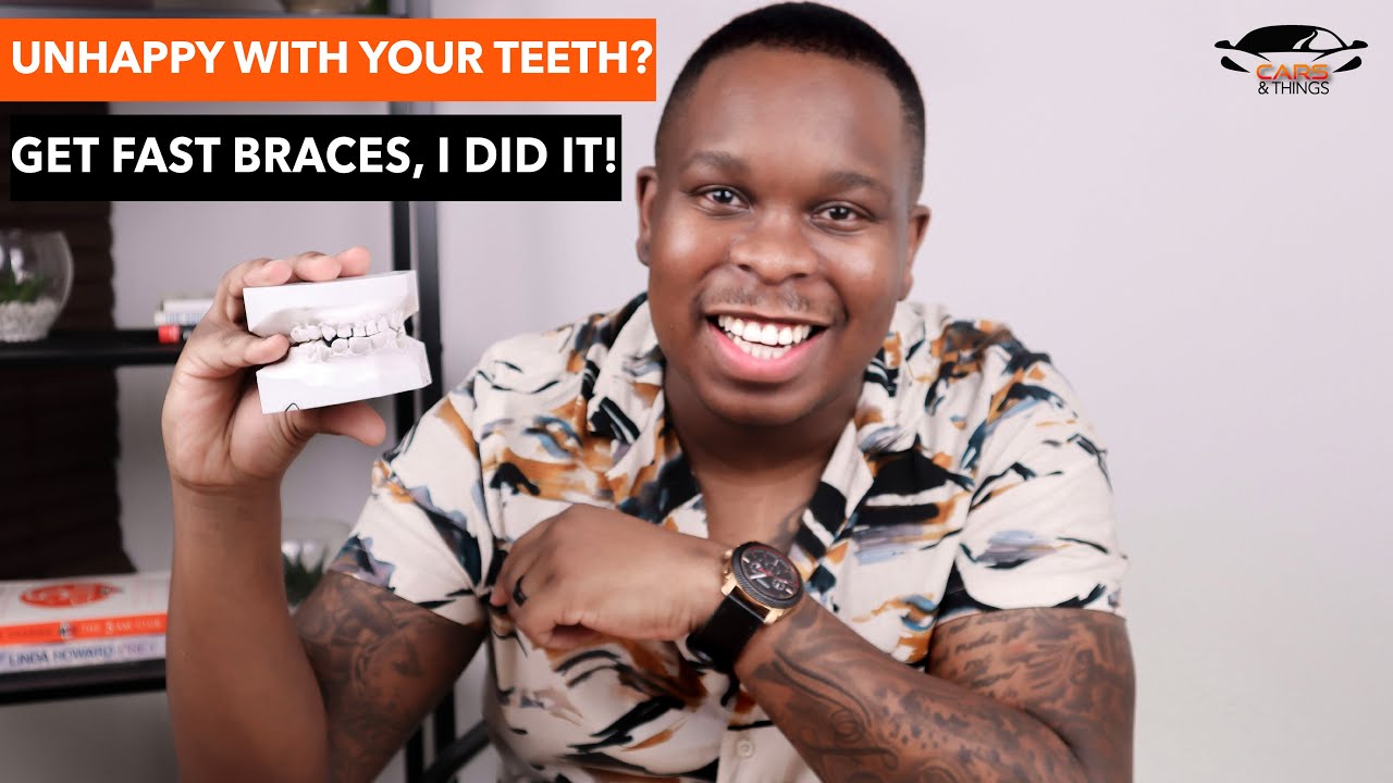 FAST BRACES TECHNOLOGY: Q&A (BEFORE & AFTER ) |  CARS & THINGS