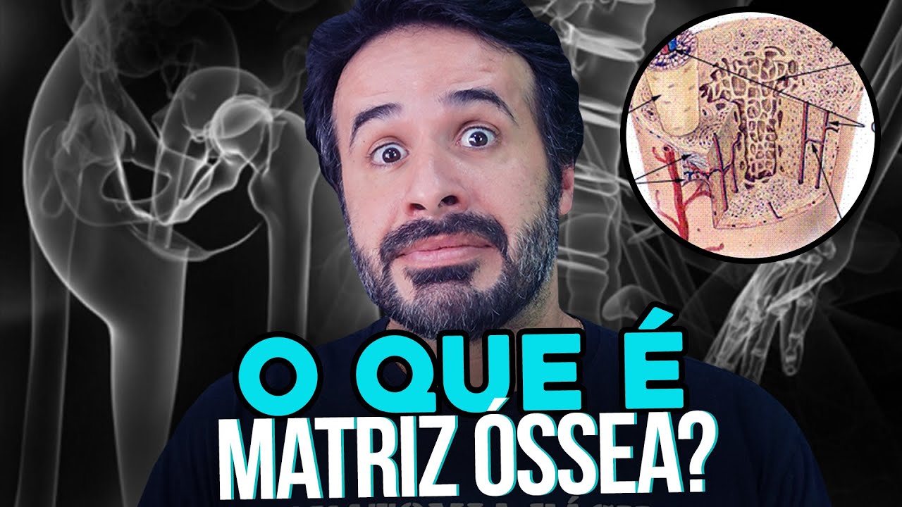 CHEGOU A HORA DE VOCÊ SABER O QUE É MATRIZ ÓSSEA.