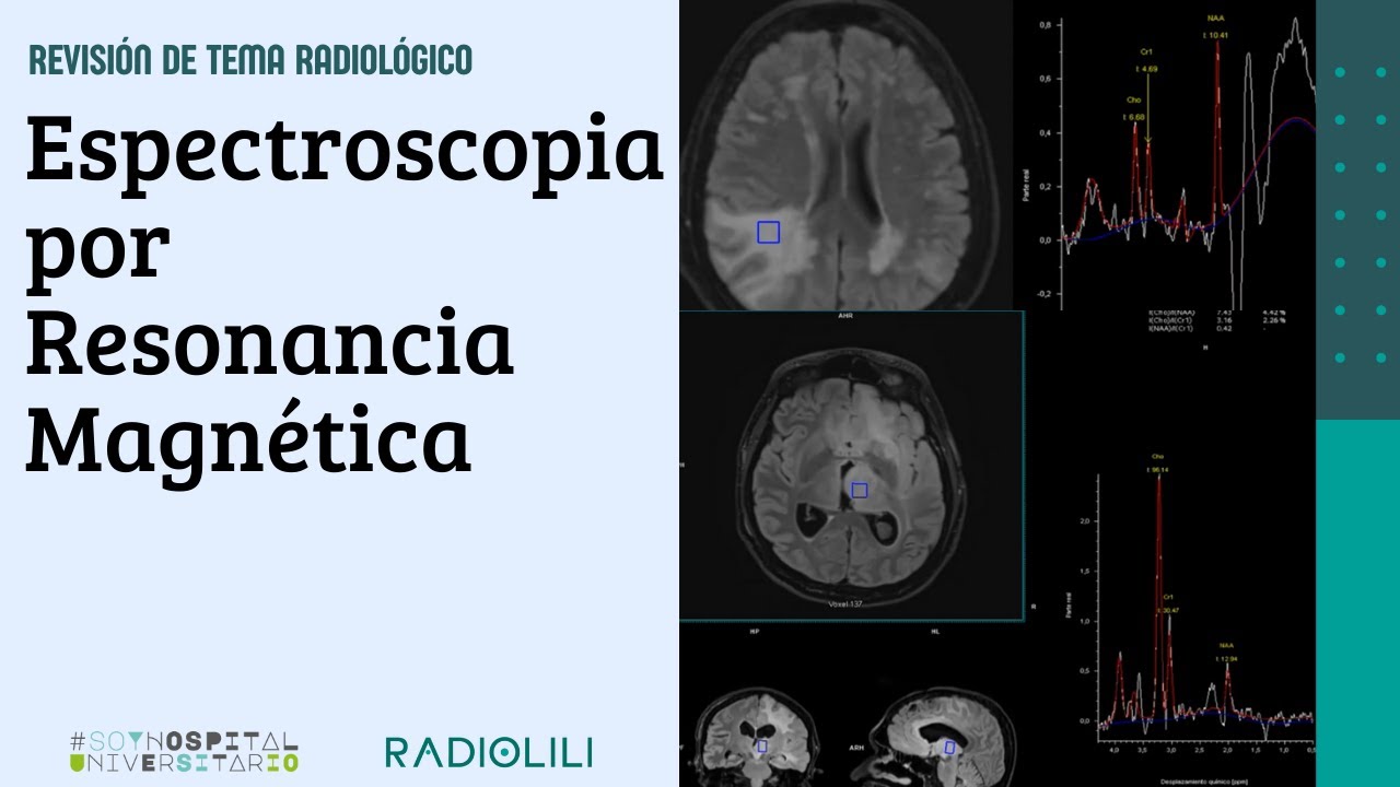 Espectroscopia por resonancia magnética
