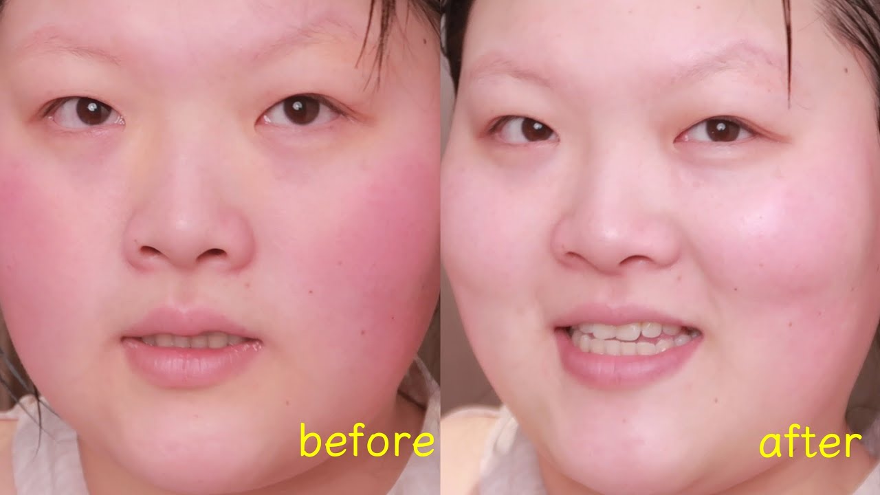 换季烂脸？整点狠活！急救手法都来学～