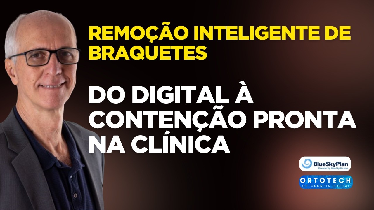 Como remover braquetes virtualmente e ganhar tempo clínico?