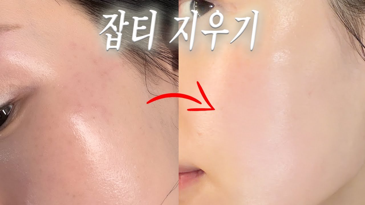 누런 피부&잡티 극복하는 방법 | 🍑#미백크림 2차 최저가 마켓 🍑