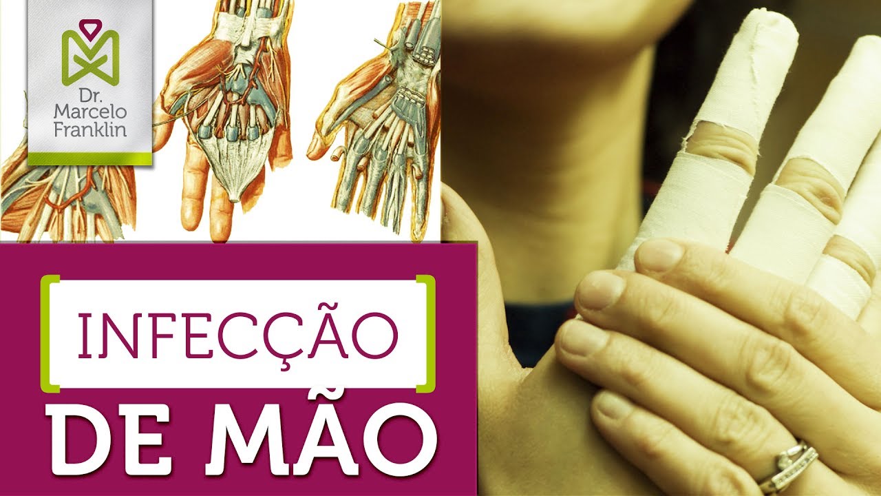 Infecção da mão