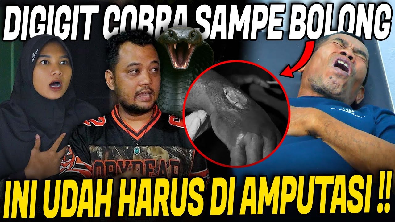 NOLONG KORBAN GIGITAN ULAR COBRA PENYEMBUR !! TANGANNYA UDAH BOLONG DAN BERN4N4H !!