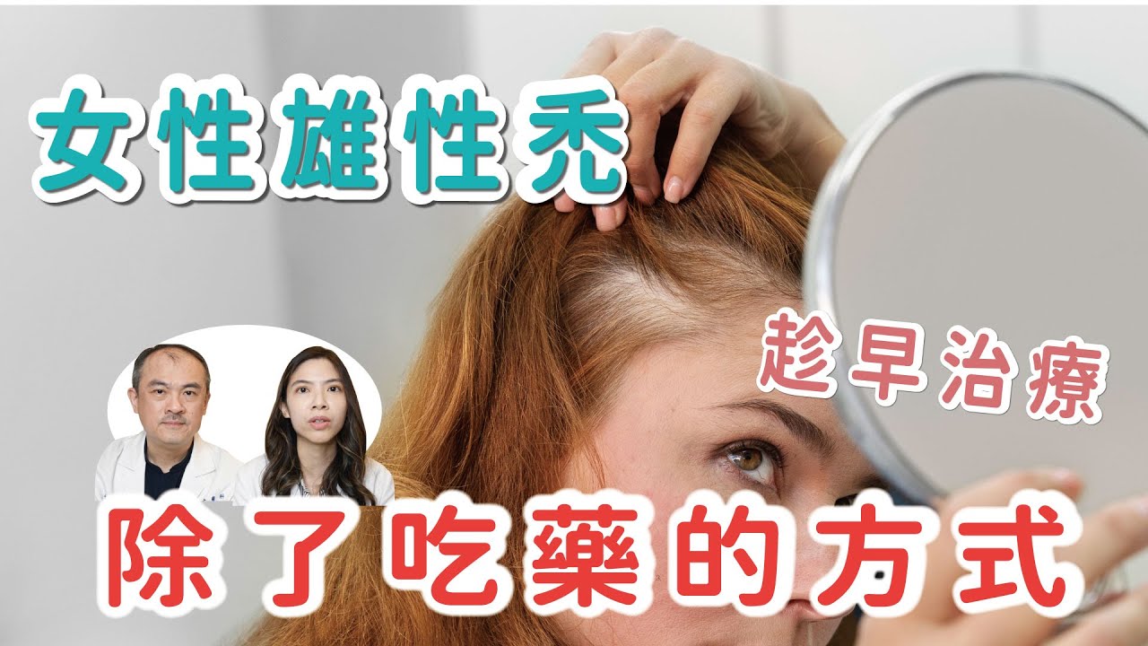 女性雄性禿除了口服藥物外的三種治療方式，及早治療避免禿頭(可開啟自動翻譯)