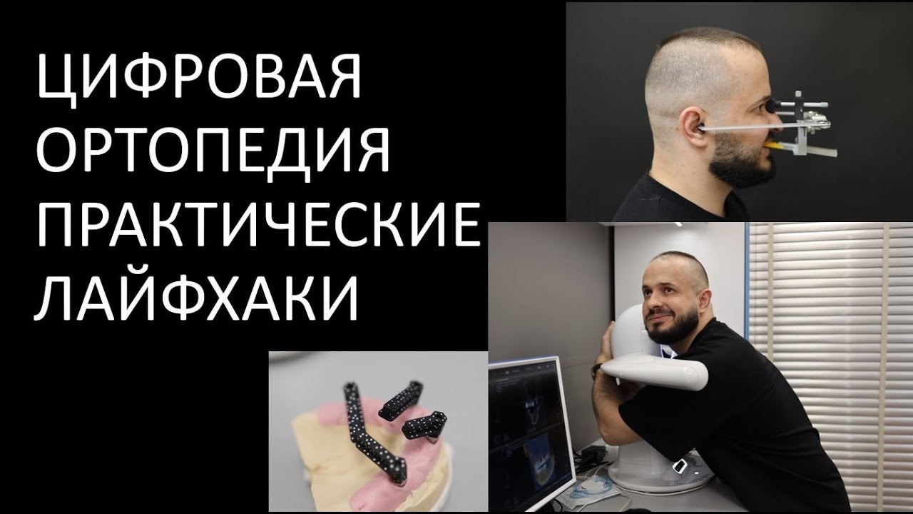 ЦИФРОВАЯ ОРТОПЕДИЯ ЧЕМ Я РАБОТАЮ