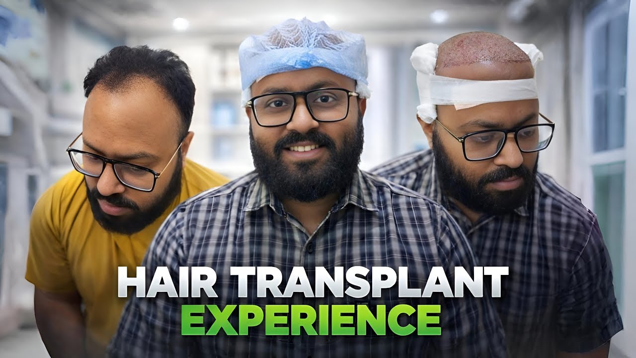 Hair transplant in indore | Best Results & Cost of Hair Transplant in indore