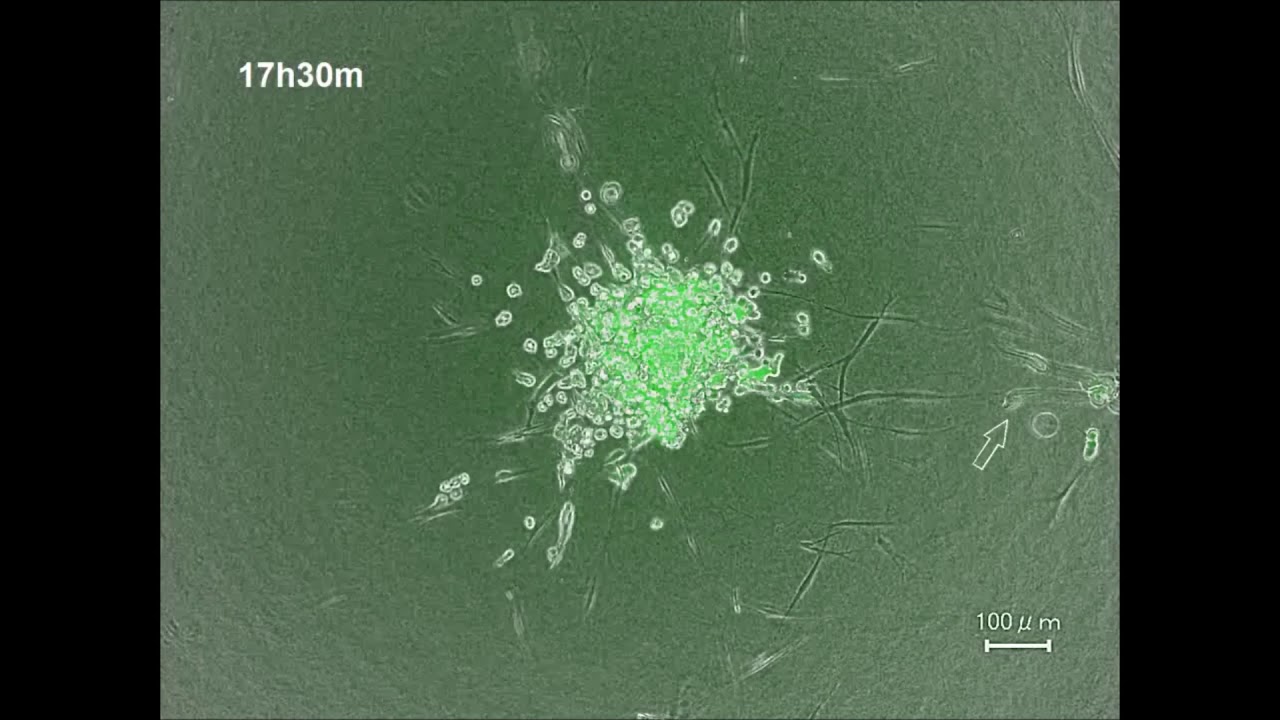 Cancer cell migration on elongate protrusions of fibroblasts in collagen matrix