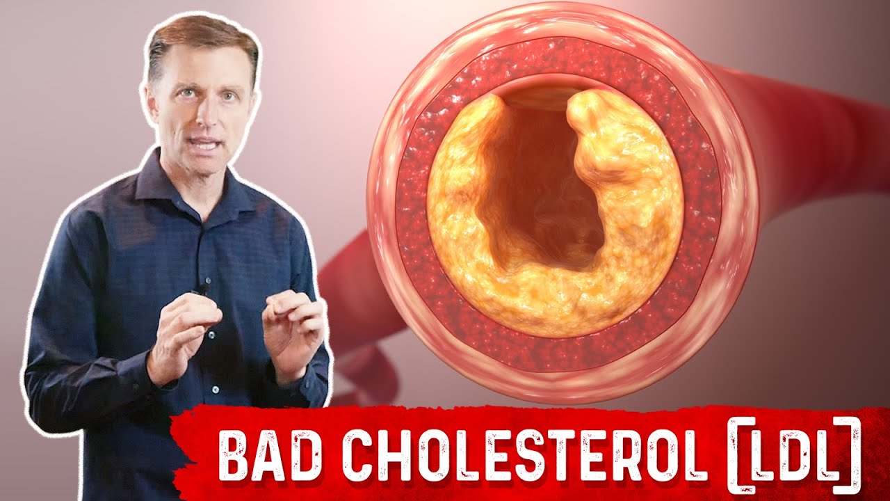 Bad Cholesterol (LDL) is NOT Cholesterol and Is NOT Bad! &ndash; Dr.Berg