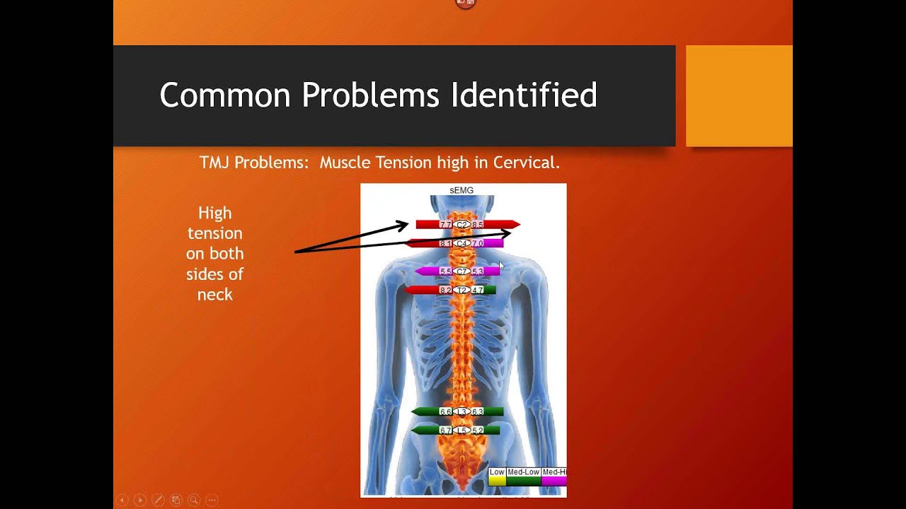 EP Stress Score: Simplifying Interpretation of Static sEMG