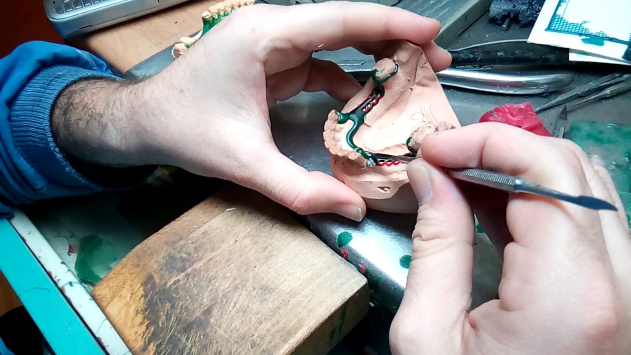 Modellazione scheletro su modello duplicato