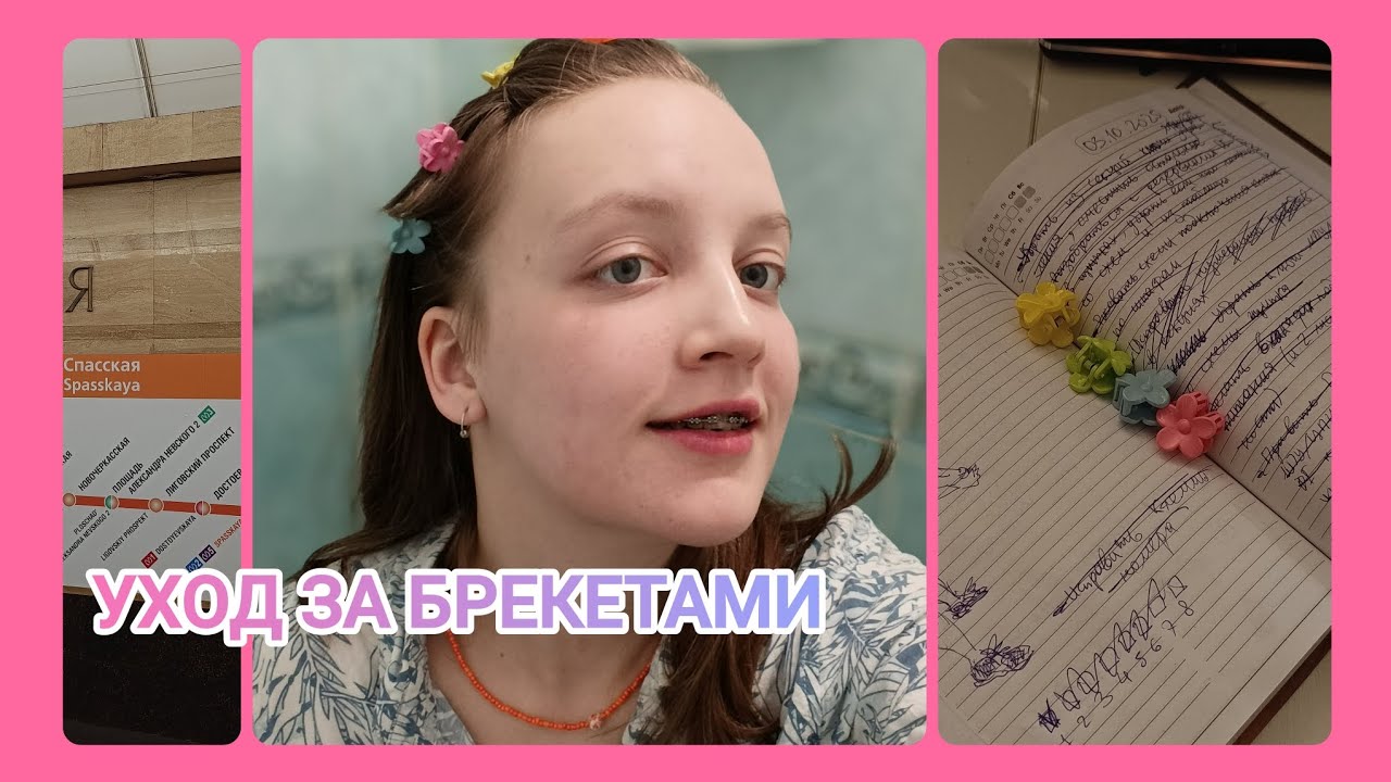 ПОМЕНЯЛА ДУГУ НА БРЕКЕТАХ  | брекеты часть 1