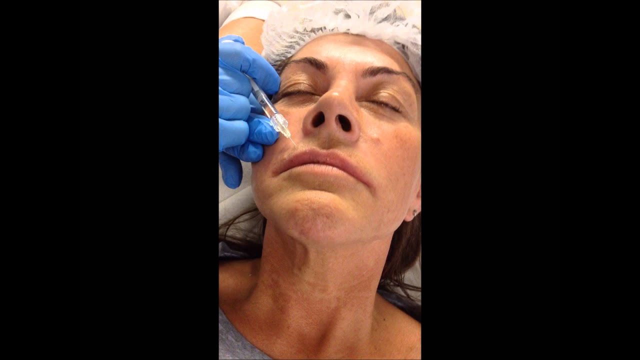 Lip Enhancement Masterclass